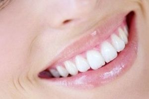 Применение зубных виниров