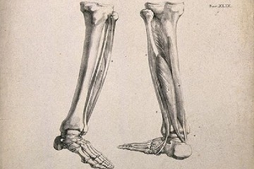 В костях ног найден сенсор лишнего веса