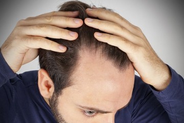 Новый препарат против выпадения мужских волос