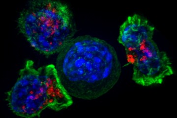 Раковые клетки научились погружать в бессрочную кому