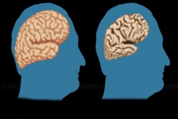 Ученые определили, что скорость возрастной деградации мозга не зависит от уровня образования