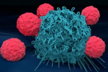 Ученые обнаружили, почему иммунная система не справляется с раковыми клетками 