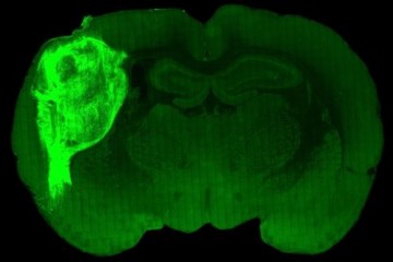 Клетки мозга человека интегрированы в мозг крыс
