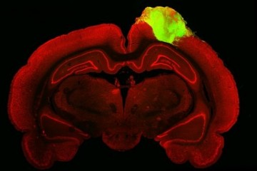 Органоиды человека восстанавливают крысиный мозг