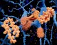 Ученые разработали антитела, распознающие бляшки при болезни Альцгеймера
