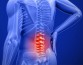 Комбинированная терапия эффективнее справляется с хронической болью в спине