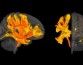 Исследователи нашли девять участков мозга, особенно подверженных влиянию давления