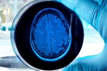 Британские ученые выращивают искусственные мозги
