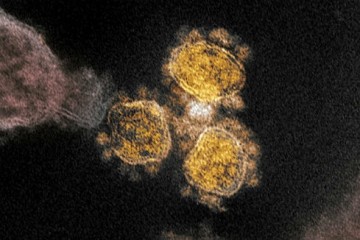 Новые анализы SARS-CoV-2 говорят о естественном происхождении коронавируса