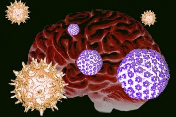 Обычные вирусы — триггеры болезни Альцгеймера?