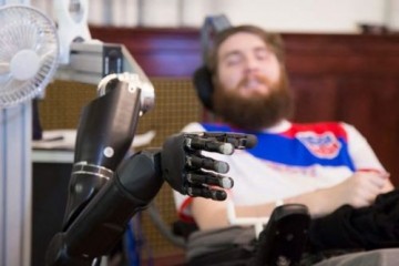 36-летний мужчина управляет роботами и видеоиграми с помощью мозговых имплантатов