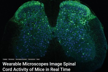 Ученые создали имплантируемый микроскоп