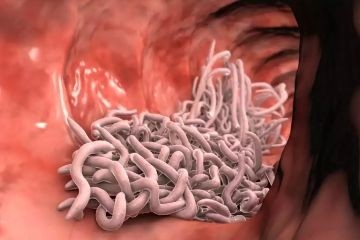 Исследователи определили, что «вакцинация» живыми червями снижает риск развития диабета