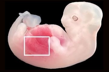 Эмбриональные почки человека выращены в свиньях