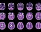 Ученые проследили по 125 тысячам сканов изменения мозга от утробы матери до старости 