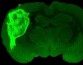Исследователи интегрировали органоиды мозга из стволовых клеток человека в мозг новорожденных крыс
