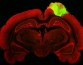 Органоиды человеческого мозга, имплантированные в мозг крысы, восстанавливают его