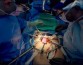 Американские врачи впервые успешно пересадили человеку свиную почку