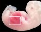 Китайские ученые впервые вырастили эмбриональные почки человека в организме свиней